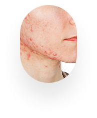 Dermatólogo online evaluando alergias y enfermedades de la piel por Telemedicina OnDemand